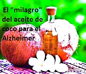 aceite-de-coco-alzheimer