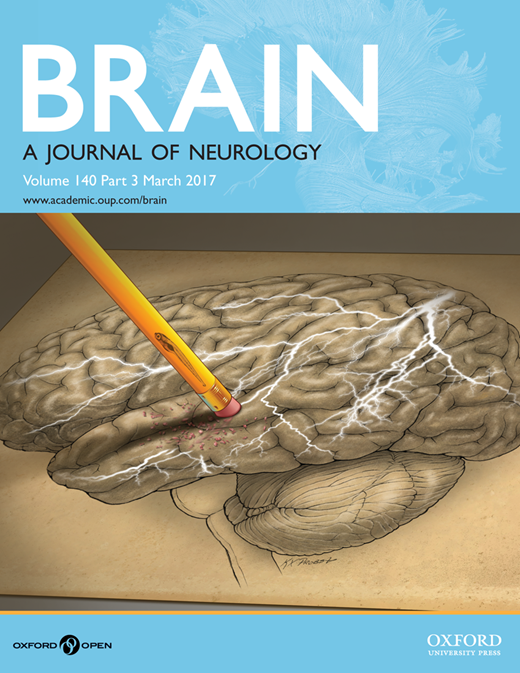 brain-journal-of-neurology-alzheimer