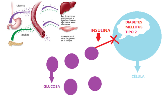 diabetes-tipo2-alzheimer