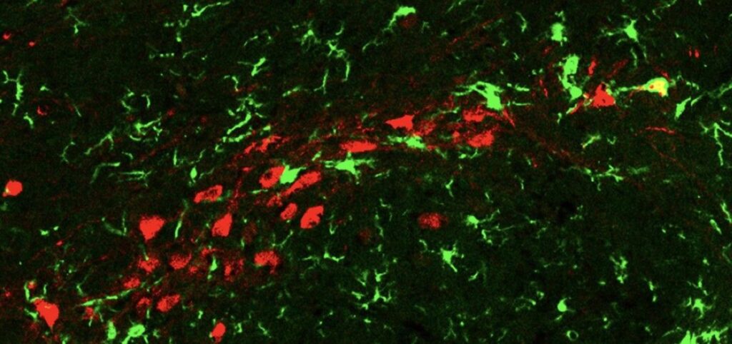 Las neuronas senescentes (rojas) desencadenan una inflamación local y son atacadas por las células inmunitarias del cerebro (verdes) (Foto. The Rockefeller University)