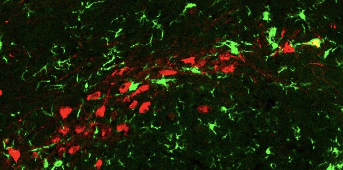 Las neuronas senescentes (rojas) desencadenan una inflamación local y son atacadas por las células inmunitarias del cerebro (verdes) (Foto. The Rockefeller University)